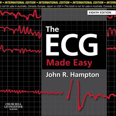 THE ECG MADE EASY ISE