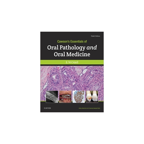 CAWSON'S ESSENTIALS OF ORAL PATHOLOGY AND ORAL MEDICINE ISE