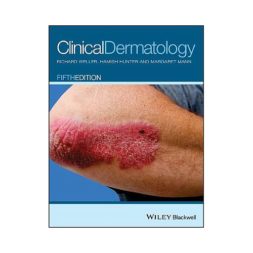 Clinical Dermatology