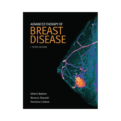 Advanced Therapy of Breast Disease