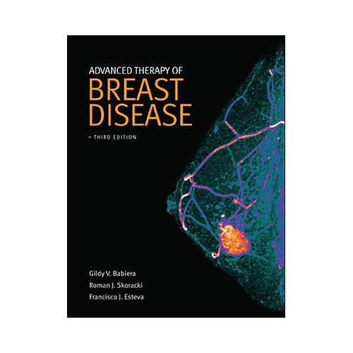 ADVANCED THERAPY OF BREAST DISEASE