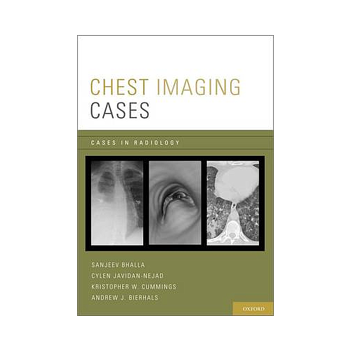 Chest Imaging Cases