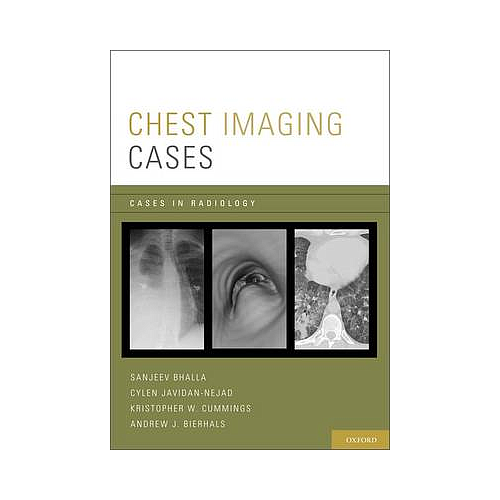CHEST IMAGING CASES