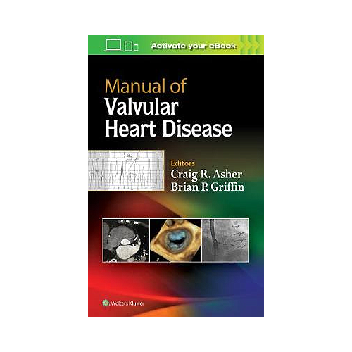 MANUAL OF VALVULAR HEART DISEASE