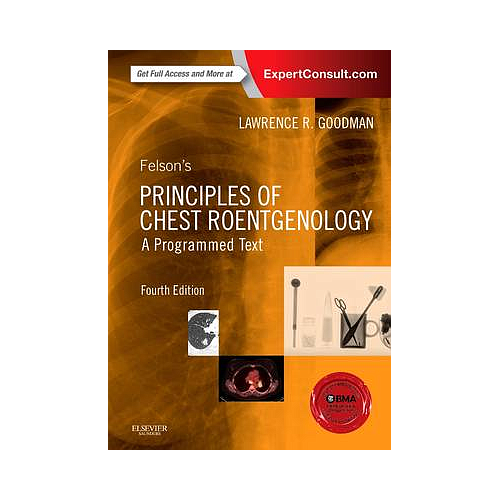 FELSON'S PRINCIPLES OF CHEST ROENTGENOLOGY